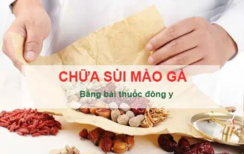 Chữa sùi mào gà bằng Đông Y có khỏi không? Cần lưu ý gì?